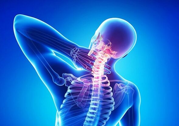 Douleur dans la colonne cervicale avec ostéochondose