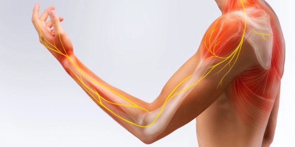 Une douleur et un engourdissement dans les doigts indiquent des lésions ligamentaires dues à une ligamentite sténosante